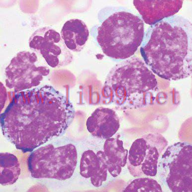 [AME]Hematopathology 2021 (CME VIDEOS)