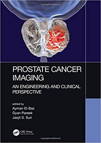 Prostate Cancer Imaging