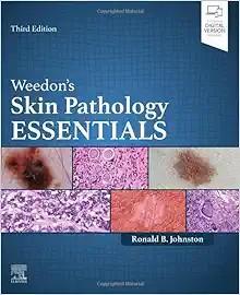 [AME]Weedon's Skin Pathology Essentials, 3rd edition (Original PDF)