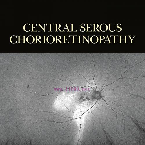 [AME]Central Serous Chorioretinopathy (EPUB)