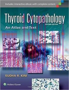 [AME]Thyroid Cytopathology: An Atlas and Text, Second Edition (EPUB)