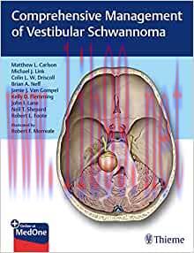 [AME]Comprehensive Management of Vestibular Schwannoma (EPUB)