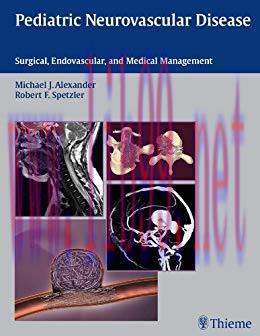 [PDF]Pediatric Neurovascular Disease