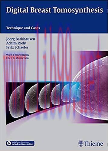 [PDF]Digital Breast Tomosynthesis - Technique and Cases (包含视频)