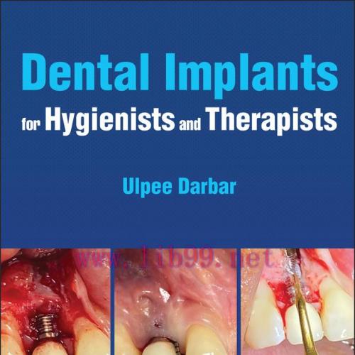 [AME]Dental Implants for Hygienists and Therapists (EPUB)