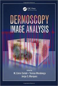 [AME]Dermoscopy Image Analysis (Digital Imaging and Computer Vision)