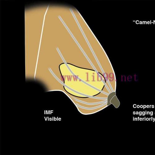 [AME]MRIOnline Imaging Mastery Series: Regulatory/Standards of Care in Breast Imaging 2021 (CME...