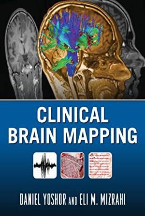 Clinical Brain Mapping