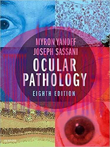 [AME]Ocular Pathology, 8th Edition (ORIGINAL PDF from_ Publisher)