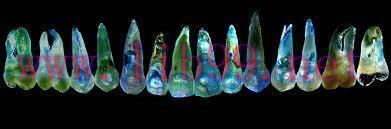 [AME]gIDEdental Online Residency Program in Esthetic Dentistry (CME VIDEOS)