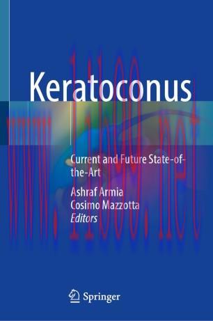 Keratoconus
