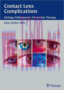 [AME]Contact Lens Complications