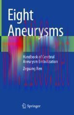 [PDF]Eight Aneurysms: Handbook of Cerebral Aneurysm Embolization