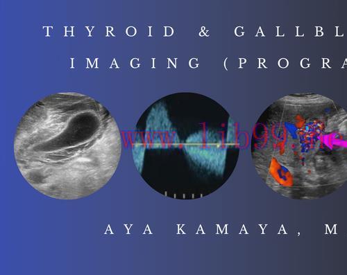 [AME]Thyroid & Gallbladder Imaging (Program 1) &ndash; Aya Kamaya, M.D. (CMEScience) (CME Videos)