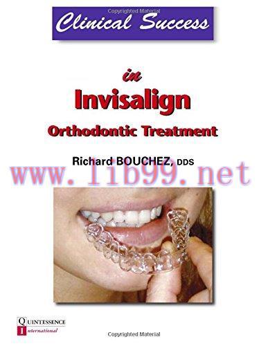 [AME]Clinical Success in Invisalign Orthodontic Treatment (EPUB)