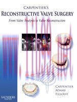 [PDF]Carpentier&rsquo;s Reconstructive Valve Surgery