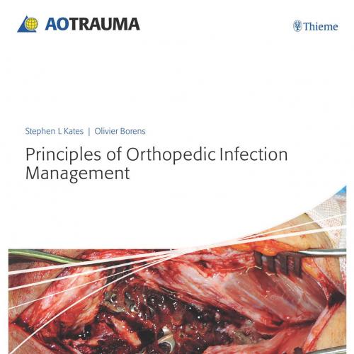 Principles of Orthopedic Infection Management