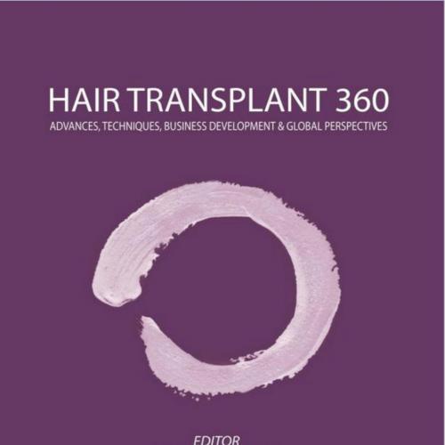Hair Transplant 360 (Advances, Techniques, Business Development, and Global Perspectives), Volu...