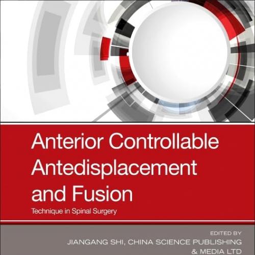 Anterior Controllable Antedisplacement and Fusion Technique in Spinal Surgery 1st Edition