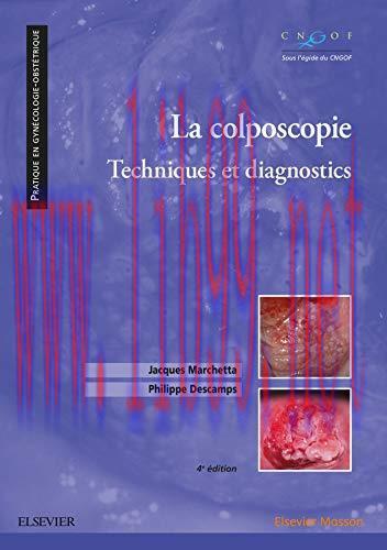 [AME]La colposcopie: Techniques et diagnostics, 4th edition (True PDF)