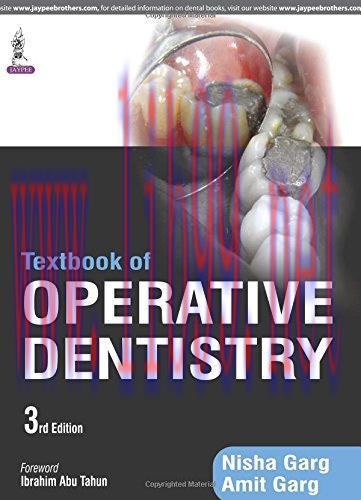 [AME]Textbook of Operative Dentistry, 3rd Edition (Original PDF)