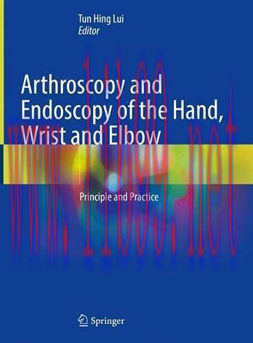 [AME]Arthroscopy and Endoscopy of the Hand, Wrist and Elbow: Principle and Practice (Original P...