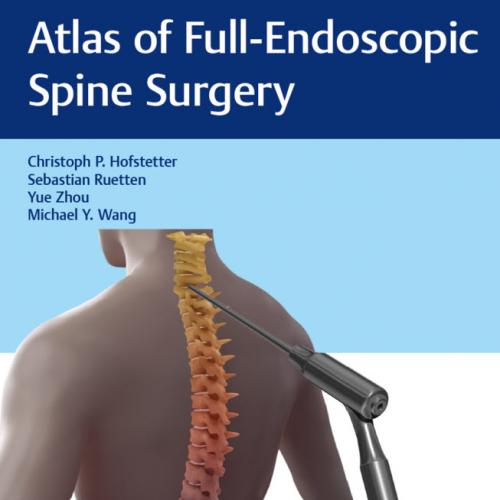 Atlas of Full-Endoscopic Spine Surgery