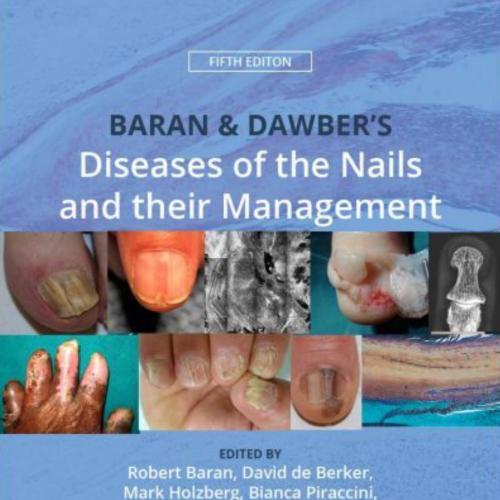 Baran and Dawber's Diseases of the Nails and their Management 5th