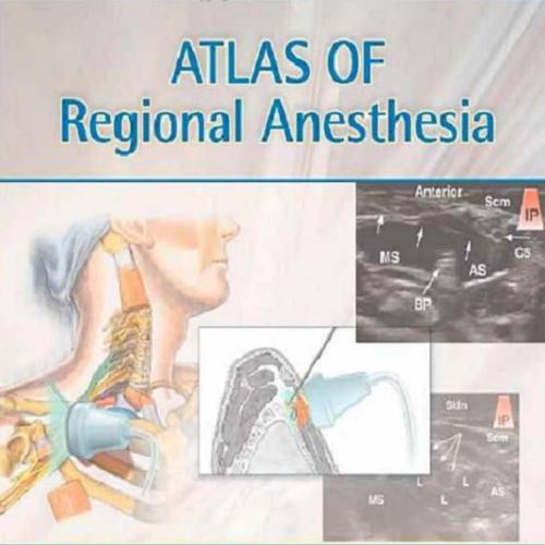 Atlas of Regional Anesthesia,4th Edition - Brown