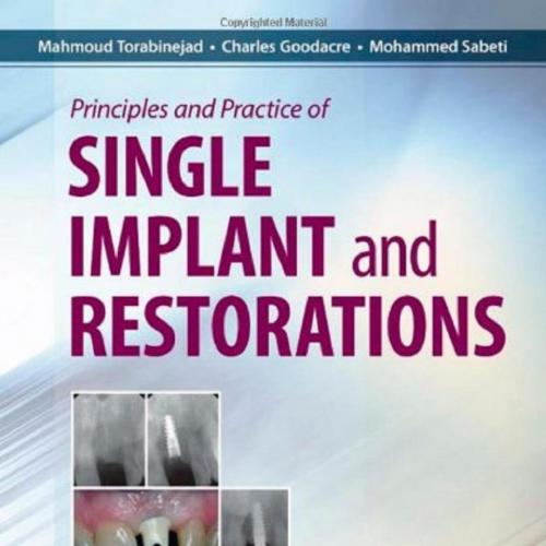 Principles and Practice of Single Implant and Restoration