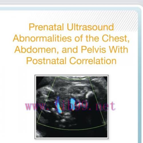 [AME]AIUM Prenatal Ultrasound Abnormalities of the Chest, Abdomen, and Pelvis With Postnatal Co...