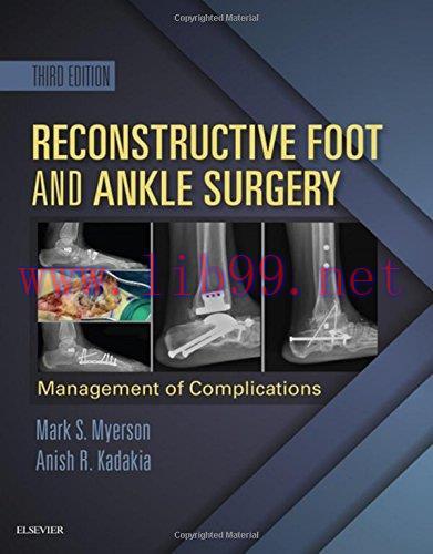 [AME]Reconstructive Foot and Ankle Surgery: Management of Complications, 3e (PDF)