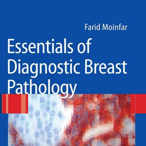 Essentials of Diagnostic Breast Pathology