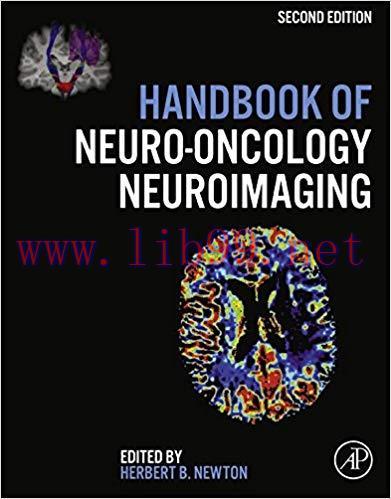(PDF)Handbook of Neuro-Oncology Neuroimaging 2nd Edition