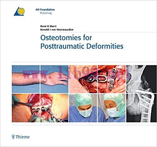 [PDF]Osteotomies for Posttraumatic Deformities 2008