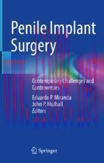 [PDF]Penile Implant Surgery: Contemporary Challenges and Controversies