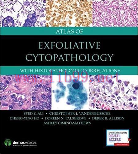 [AME]Atlas of Exfoliative Cytopathology: With Histopathologic Correlations (EPUB)