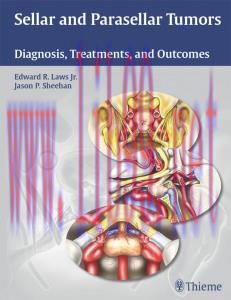 [AME]Sellar and Parasellar Tumors: Diagnosis, Treatments, and Outcomes