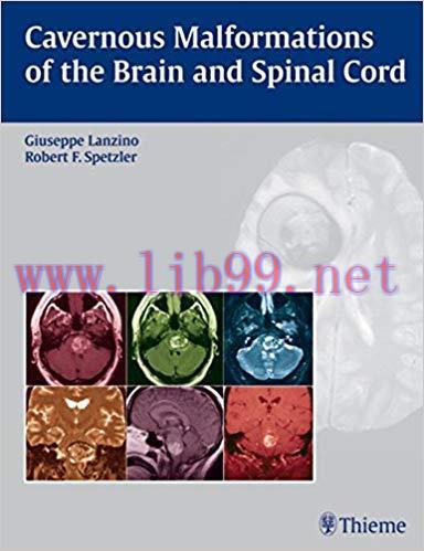[PDF]Cavernous Malformations of the Brain and Spinal Cord