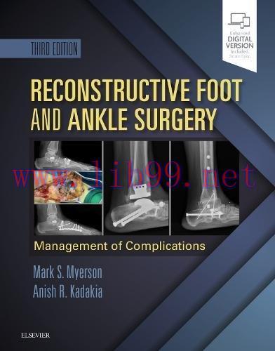 [AME]Reconstructive Foot and Ankle Surgery: Management of Complications, 3e (ePUB)