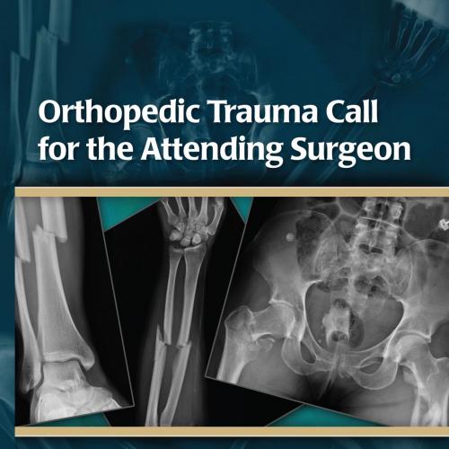 Orthopedic Trauma Call for the Attending Surgeon