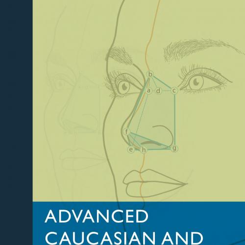 Advanced Caucasian and Mediterranean Rhinoplasty - Lohuis, P. J. F. M_