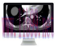 [AME]Clinical Cardiopulmonary Imaging Review 2019 (ARRS VIDEOS) (CME VIDEOS)