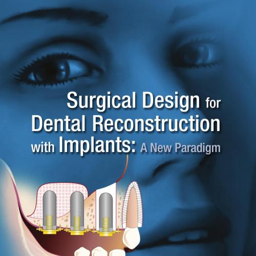 Surgical Design for Dental Reconstruction with Implants_ A New Paradigm