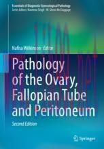 [PDF]Pathology of the Ovary, Fallopian Tube and Peritoneum