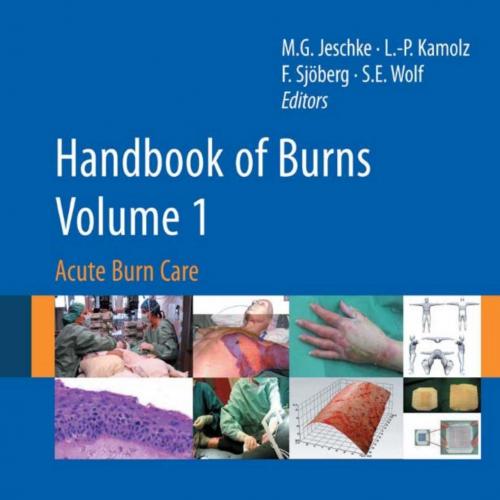 Handbook of Burns Volume 1 Acute Burn Care