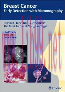 [AME]Breast Cancer: Early Detection with Mammography 1st edition (Original PDF)