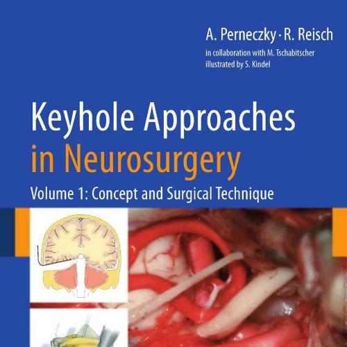 Keyhole Approaches in Neurosurgery-Volume 1-Concept and Surgical Technique