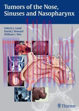 [AME]Tumors of the Nose, Sinuses and Nasopharynx (ORIGINAL PDF from_ Publisher)