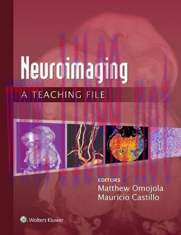 [AME]Neuroimaging: A Teaching File (EPUB)